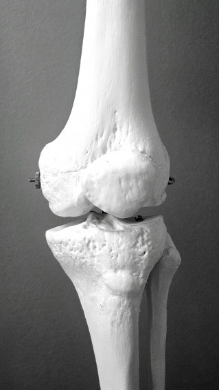 Osteoporosis