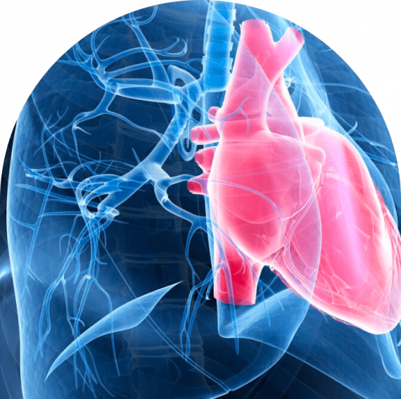 Pulmonary Arterial Hypertension