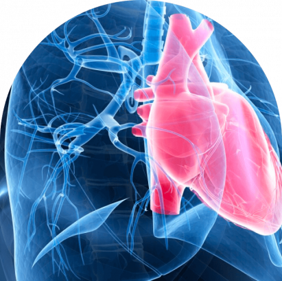 Pulmonary Arterial Hypertension